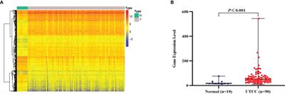 Ex Vivo Near-Infrared Molecular Imaging of Human Upper Urinary Tract Urothelial Carcinoma With a CD47-Based Targeted Tracer